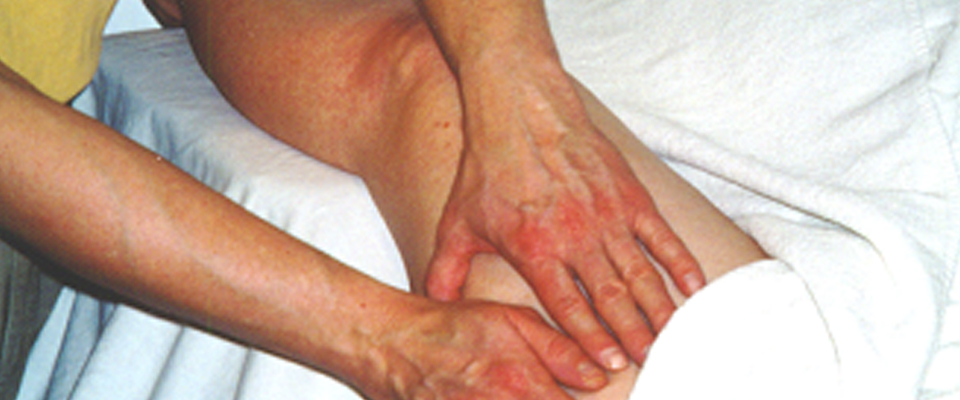 Lymphoedema Treatment